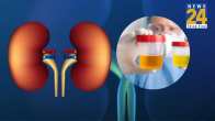 kidney diseases