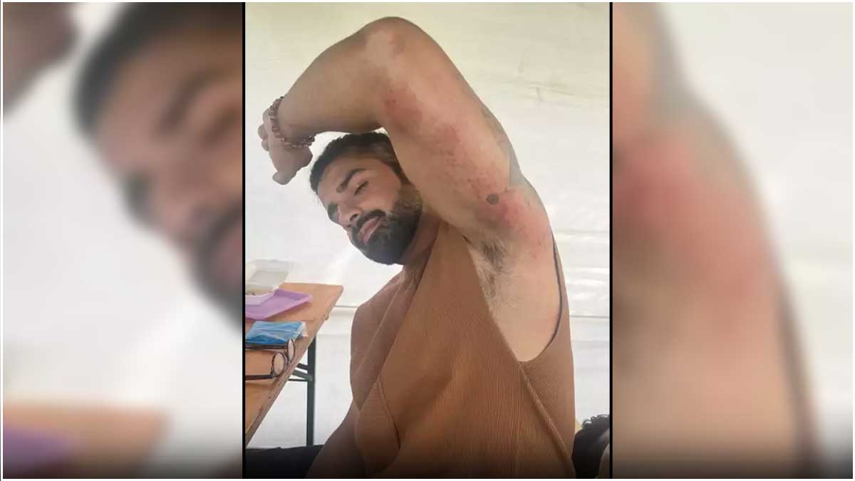 Aashish Mehrotra Injured