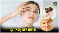 Oily Skin Care Tips