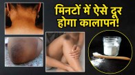home remedy for dark elbows knees neck lemon remedies