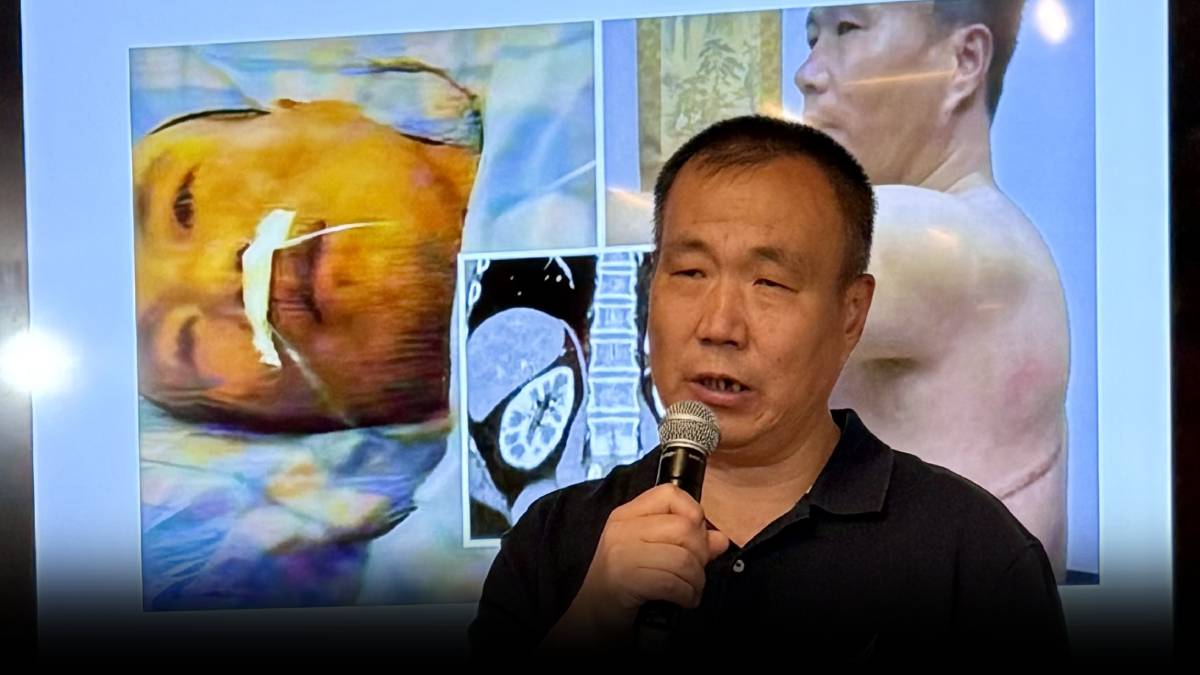 China Organ Harvesting Survivor Cheng Pei Ming