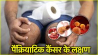 Pancreas Cancer Symptoms