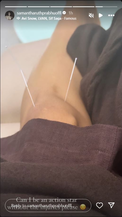 Samantha Ruth Prabhu Injured