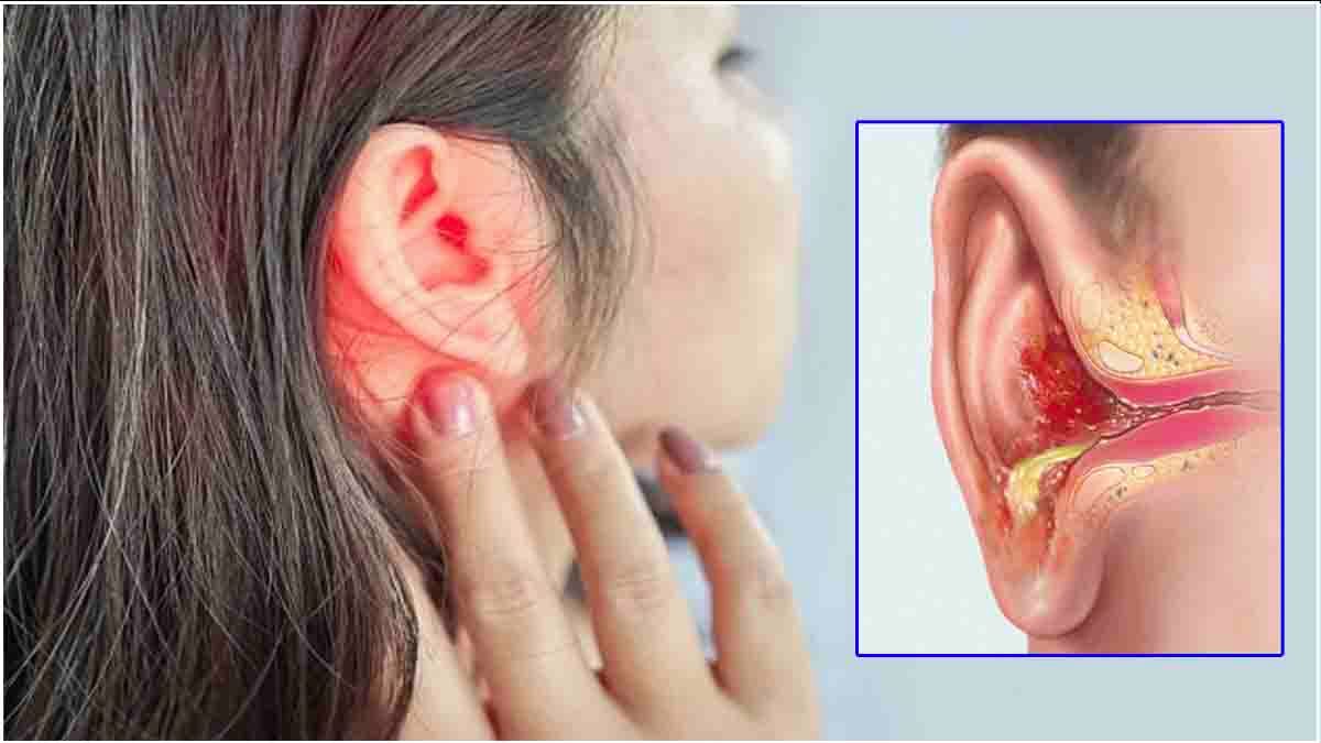 Ear Infection