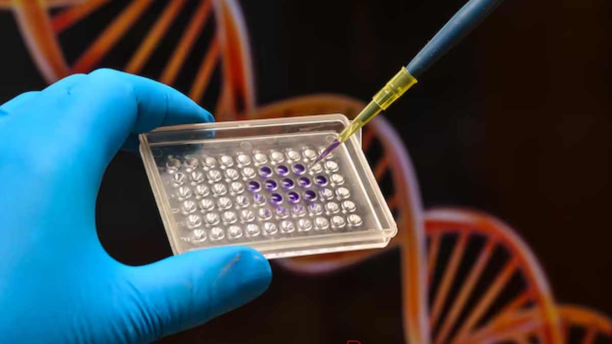 DNA Test
