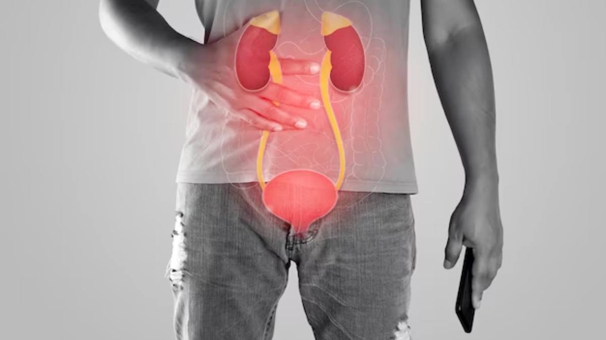 Kidney Damage Causes