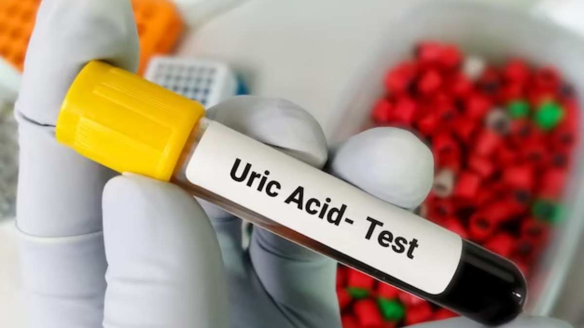 Uric Acid