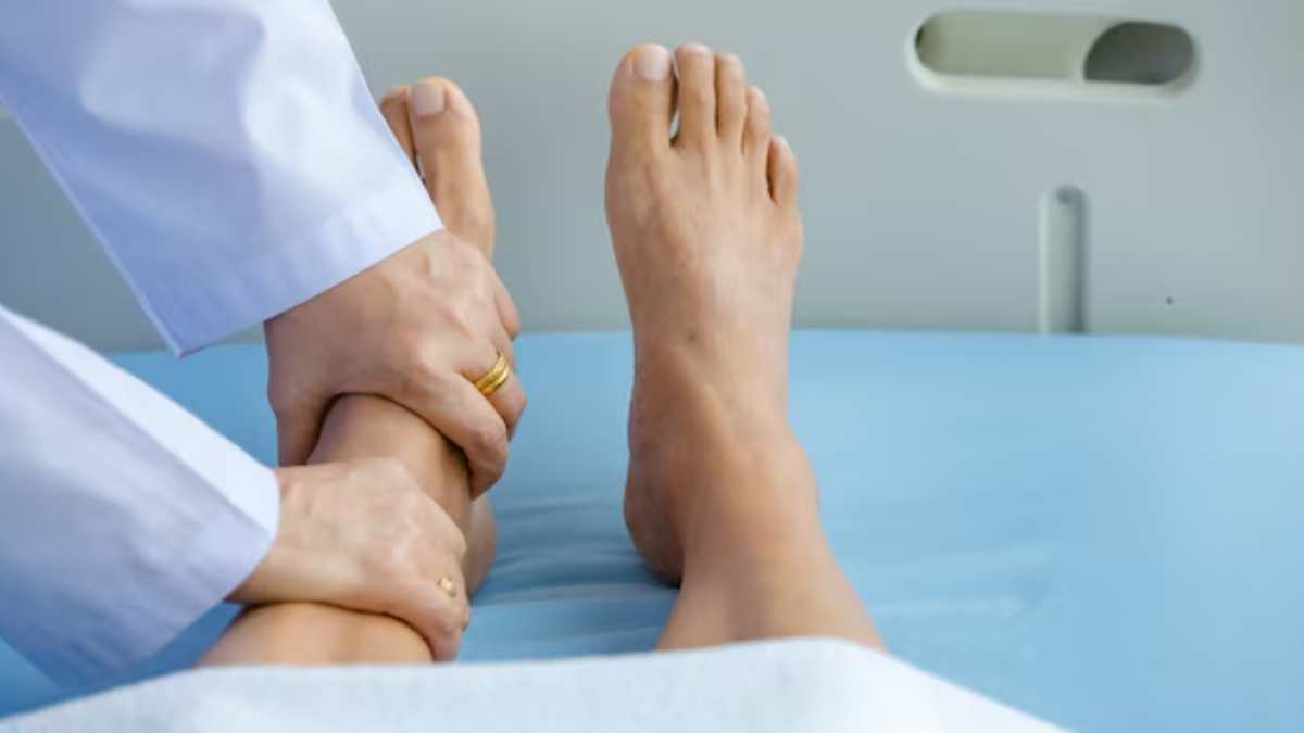 Guillain-Barr&eacute; Syndrome
