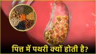 Gallbladder Stones