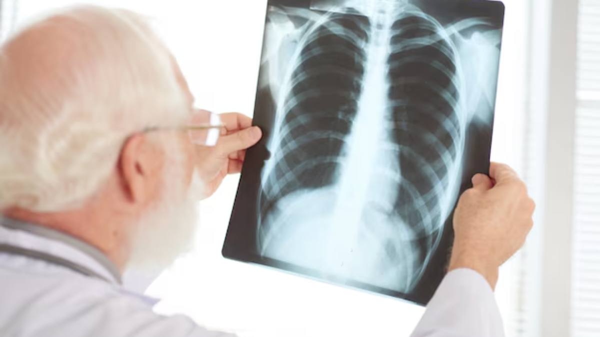 World Tuberculosis Day 2025