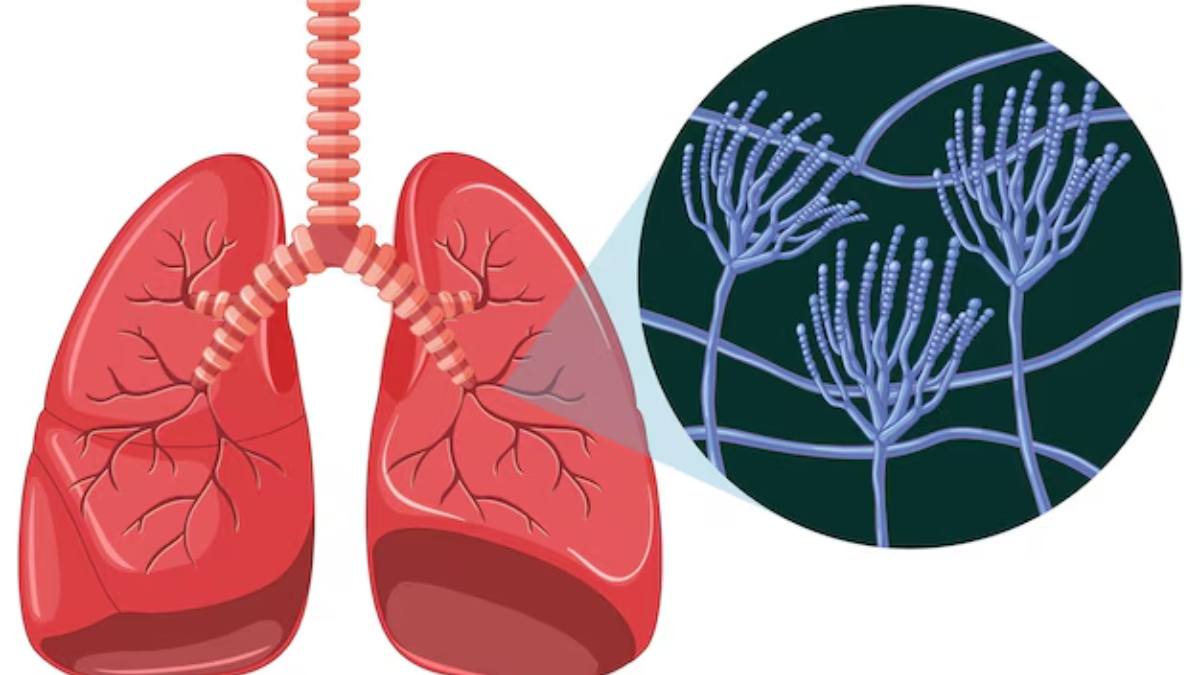  World Tuberculosis Day 2025