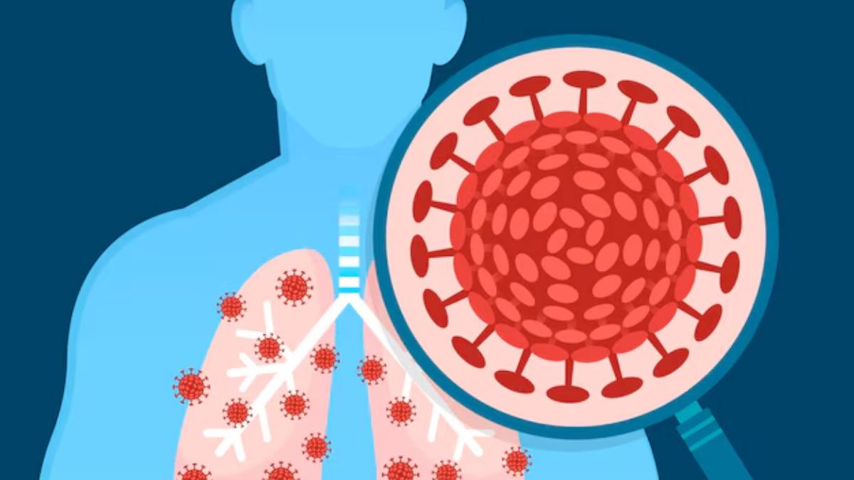 World TB Day