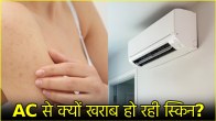 Ac side effects