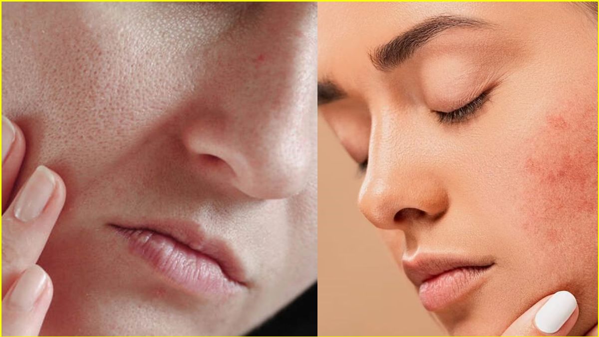 Skin Care Tips