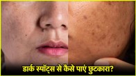 Skin Care Tips