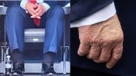 Donald Trump | US President | Health Update