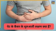Stomach Cancer