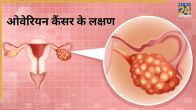 Ovarian Cancer