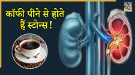 kidney stone symptoms