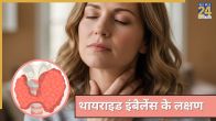 Thyroid Imbalance