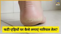 Cracked Heels Home Remedies