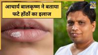 Dry Lips