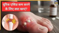 High Uric Acid
