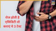 Acidity Causes