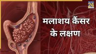 Rectal Cancer Symptoms