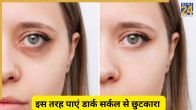 Dark Circles