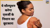skin allergy marks removal