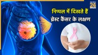 breast cancer signs