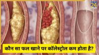 Cholesterol Diet