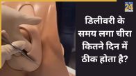 Episiotomy
