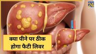 Fatty Liver Disease