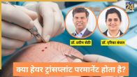 Hair Transplant