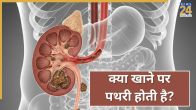 Kidney Stones
