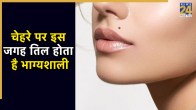 Moles on Face