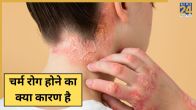 Skin Diseases