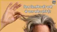 Vitamin Deficiency And White Hair