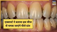 Yellow teeth
