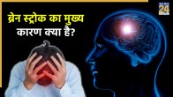 brain stroke