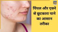 homemade Acne Free face spray