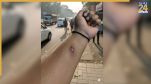 AI, AI images, AI technology, social media, company employees, company HR, fake injury, एआई, एआई इमेज, एआई तकनीक, सोशल मीडिया, कंपनी कर्मचारी, कंपनी एचआर, नकली चोट