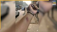 AI, AI images, AI technology, social media, company employees, company HR, fake injury, एआई, एआई इमेज, एआई तकनीक, सोशल मीडिया, कंपनी कर्मचारी, कंपनी एचआर, नकली चोट