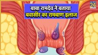 Bawasir Ka Ilaj