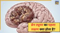 Brain Tumor