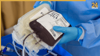 HIV Positive Blood