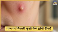 Pimples