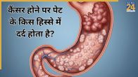 Stomach Cancer
